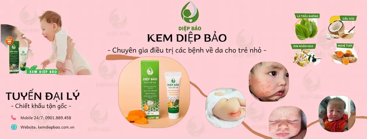 Kem Diệp Bảo 1 Kem Bôi Thảo Dược Trị Hiệu Quả Và An Toàn Các Vấn Đề Ngoài Da Như: Chàm Sữa, Viêm Da Cơ Địa, Hăm Tã, Rôm Sảy, Mẩn Ngứa, Cứt Trâu, Côn Trùng Đốt, Da Khô Nứt Nẻ… Cho Trẻ Nhỏ